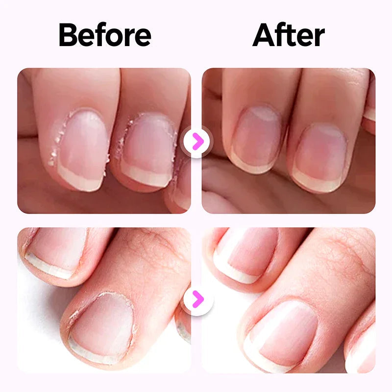 PureNail™ Care Pen — Reveal irresistibly strong, smooth nails that boost your confidence instantly