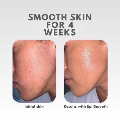 LumiVelvet™ — Unlock Lasting Silky Smoothness Without Pain or Irritation