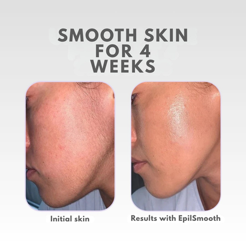 LumiVelvet™ — Unlock Lasting Silky Smoothness Without Pain or Irritation