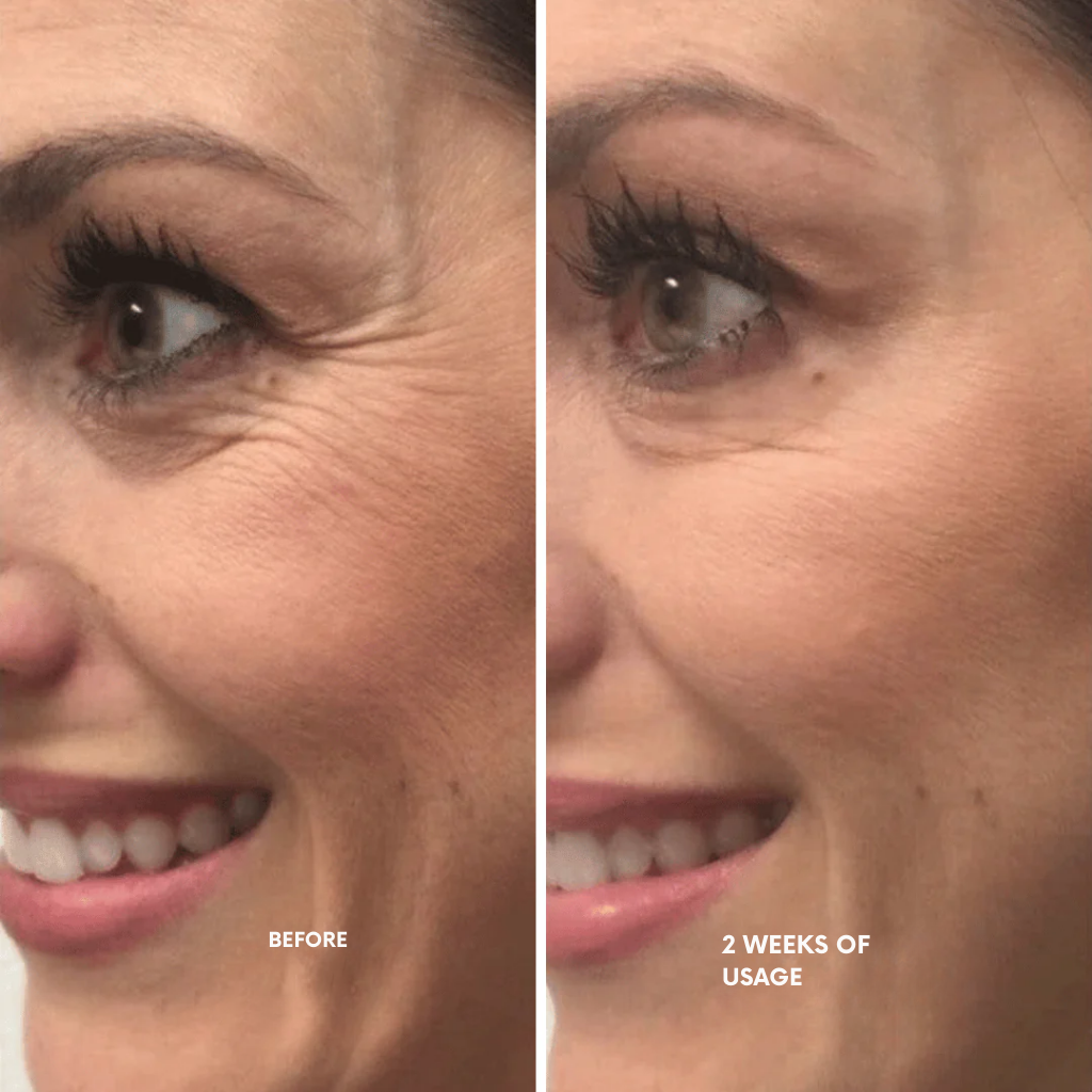 LumaLift™ — Unlock Radiant, Youthful Skin You’ll Crave to Show Off