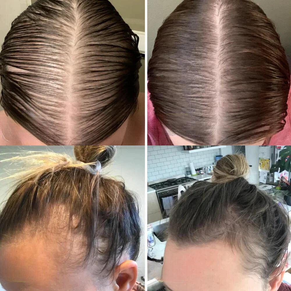 RadiantRoot™ — Ignite Your Scalp, Unlock Thick, Head-Turning Hair Every Day