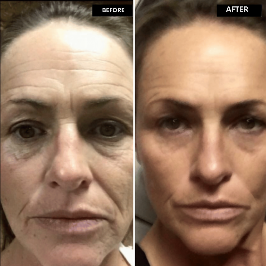 LumaLift™ — Unlock Radiant, Youthful Skin You’ll Crave to Show Off
