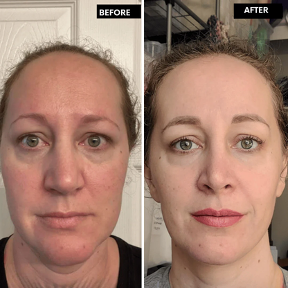 LumaLift™ — Unlock Radiant, Youthful Skin You’ll Crave to Show Off