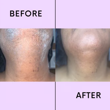 VelvaSmooth™ — Effortless Facial Hair Removal for Radiantly Smooth, Touchable Skin