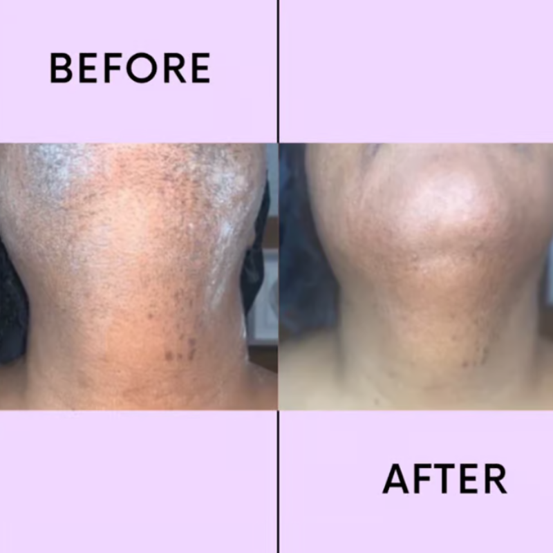 PureLuma™ — Melt Away Hair and Reveal Silky, Irritation-Free Skin Instantly