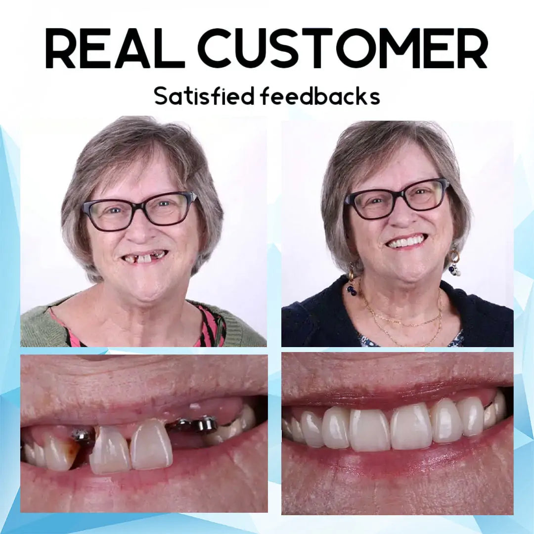 VivaVow™ — Unlock All-Day Comfort and Rock-Solid Confidence for Your Smile