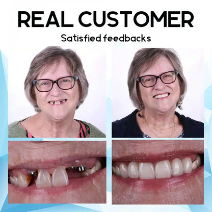 VivaVow™ — Unlock All-Day Comfort and Rock-Solid Confidence for Your Smile