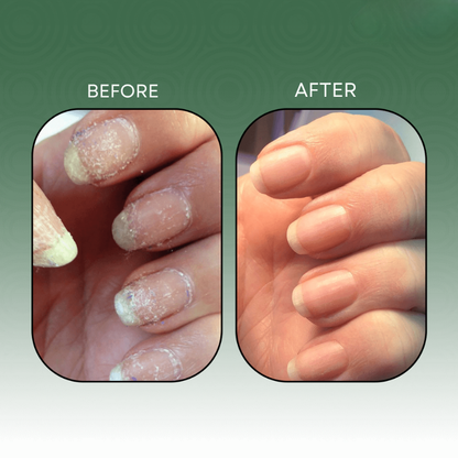AuraTough™ — Unleash Nails That Radiate Strength and Stunning Confidence