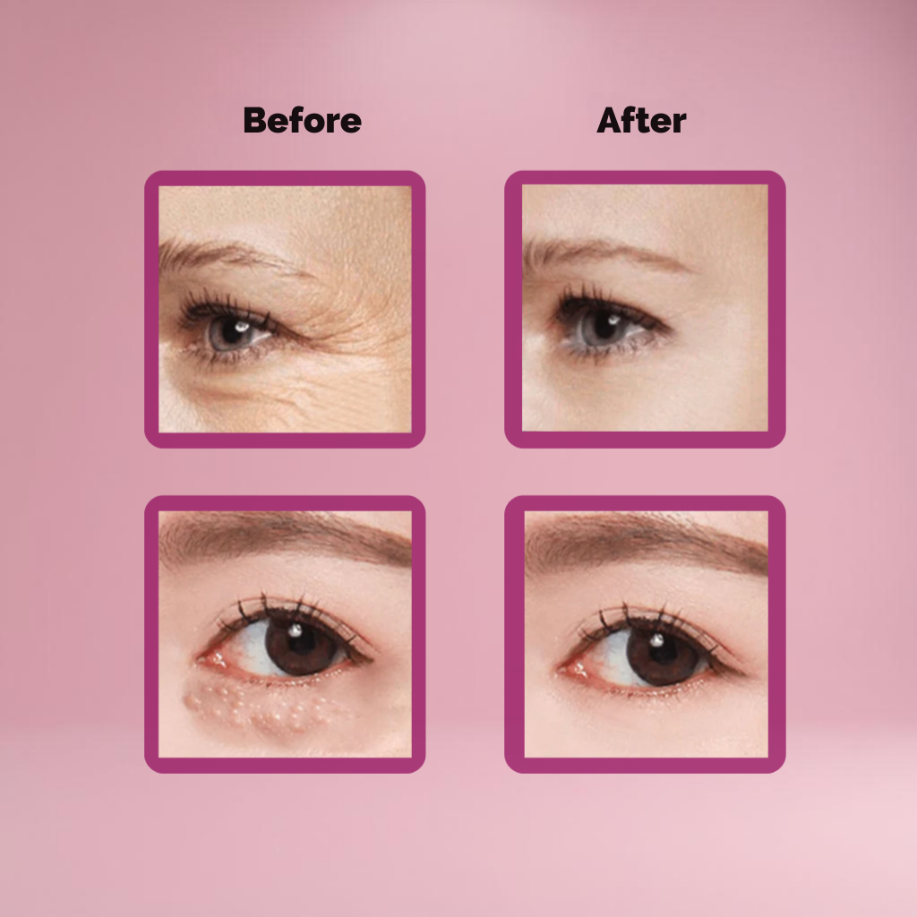 AerisVive™ — Instantly Lift and Refresh Tired Eyes for Unstoppable Confidence