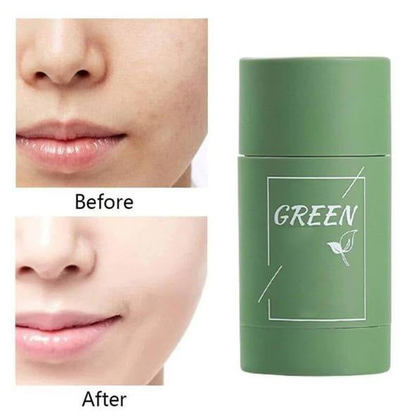 PureRadiance™ Detox Mask Stick — Clear Pores, Boost Glow, and Feel Confident Every Day
