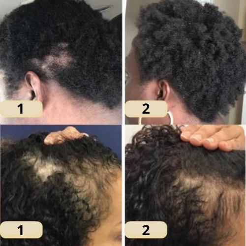 RadiantRoot™ — Ignite Your Scalp, Unlock Thick, Head-Turning Hair Every Day