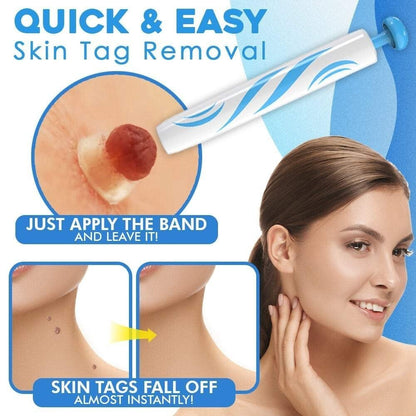 Silquease™ — Effortless Tag Removal That Restores Your Radiant Confidence Fast
