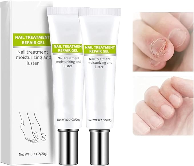 PowerLuxe™ Nail Revival Gel — Unleash Radiant, Unbreakable Nails That Command Attention