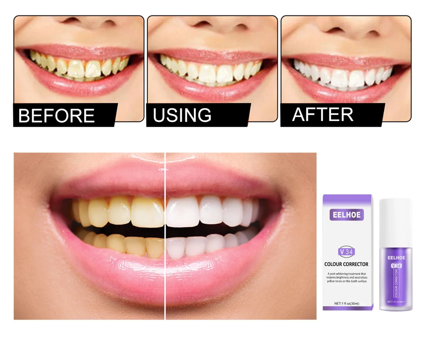 RadianceWhirl™ — Instantly Brighten Your Smile Without Pain or Wait