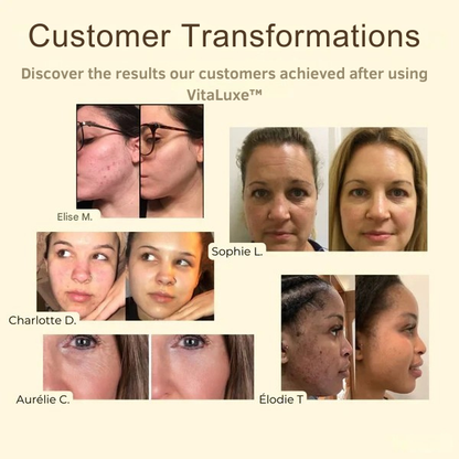 RadianceRevive™ Detox Mask — Unlock Radiant, Youthful Skin That Commands Attention Every Time