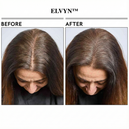 PureShade™ — Instantly Reclaim a Fuller, Naturally Youthful Hairline Without the Hassle