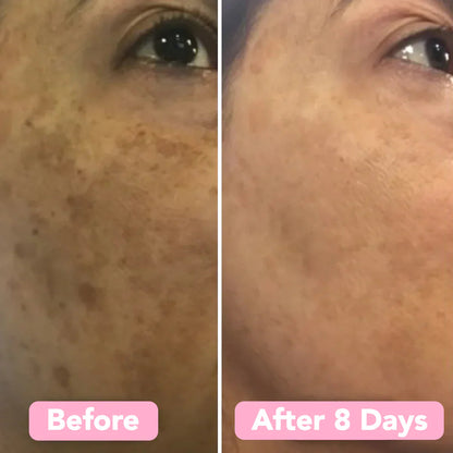 RadianceRush™ Renewal Pads — Wake Up Glowing with Smooth, Spot-Free Skin Every Day