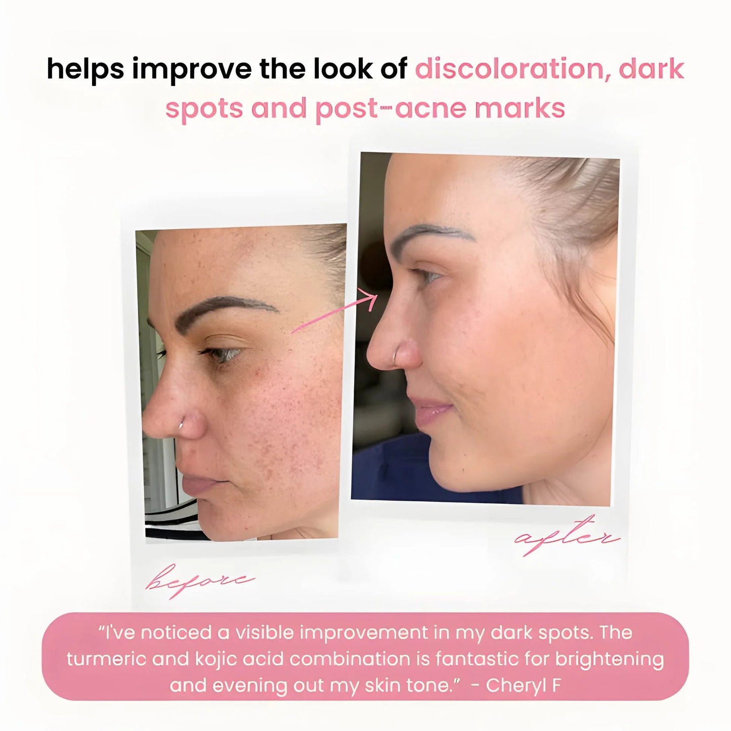 RadianceRush™ Renewal Pads — Wake Up Glowing with Smooth, Spot-Free Skin Every Day