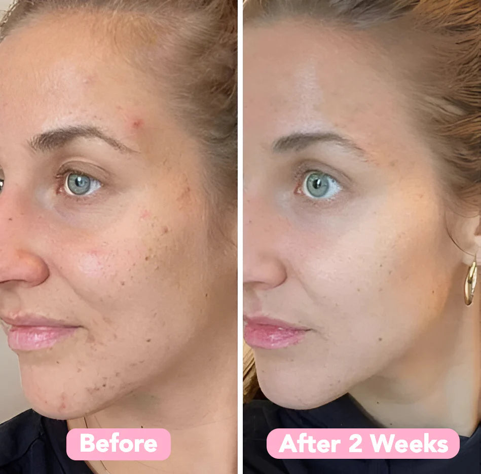 RadianceRush™ Renewal Pads — Wake Up Glowing with Smooth, Spot-Free Skin Every Day