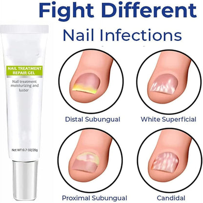 PowerLuxe™ Nail Revival Gel — Unleash Radiant, Unbreakable Nails That Command Attention