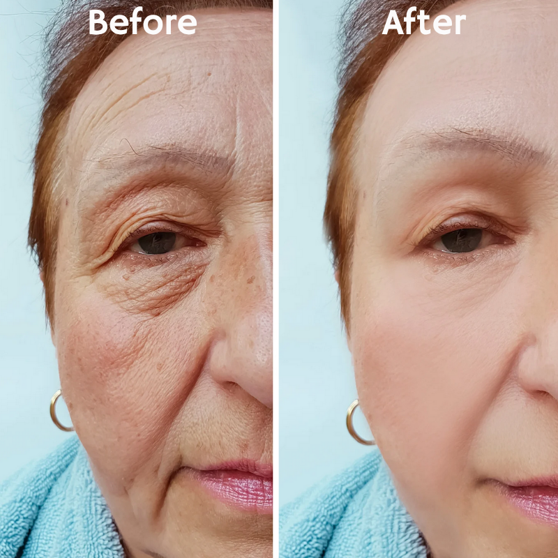 LumaLift™ — Instantly Tighten and Glow with Age-Defying Power