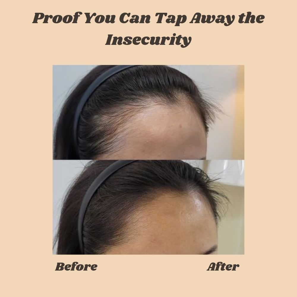 VoluBloom™ — Instantly Vanish Thinning Spots for Bold, Unshakable Confidence