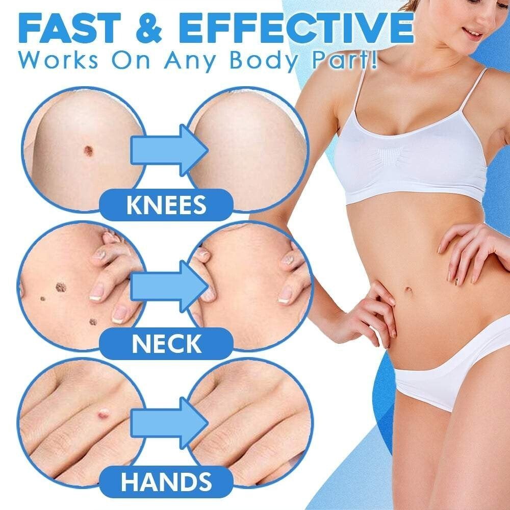 Silquease™ — Effortless Tag Removal That Restores Your Radiant Confidence Fast