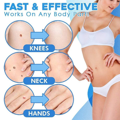 Silquease™ — Effortless Tag Removal That Restores Your Radiant Confidence Fast