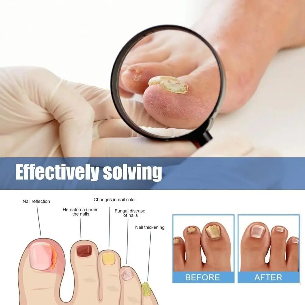 OnyraShield™ — Finally Reveal Clear, Strong Nails That Boost Your Confidence Every Day