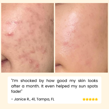 EELHOE Eternity™ — Erase Dark Spots, Reveal Glowing Skin | 1+1 FREE