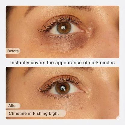 RadiantEdge™ — Erase Dark Circles & Puffiness for Youthful, All-Day Bright Eyes