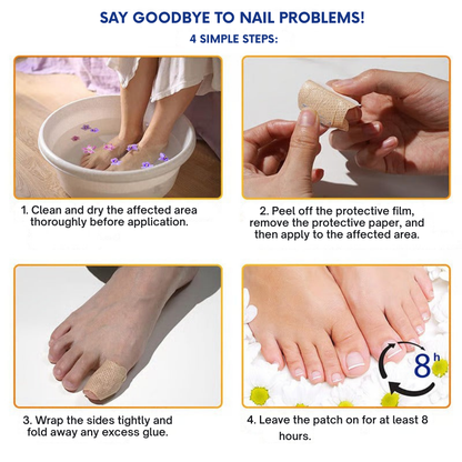 FungiShield™ Patches — Silent, Powerful Defense for Nails You’re Proud to Show Off