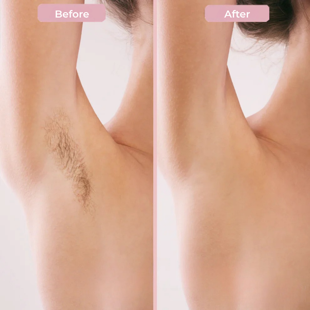 SilkBurst™ — Instantly Amplify Your Formulas with Plush Volume and Silky Smooth Luxury