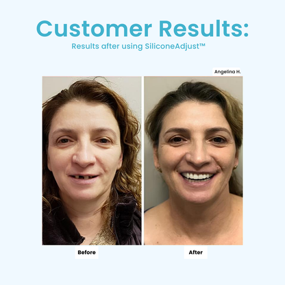 SilicoSoft™ Denture Cushions — Experience All-Day Comfort That Lets You Smile, Speak, and Enjoy Life Pain-Free