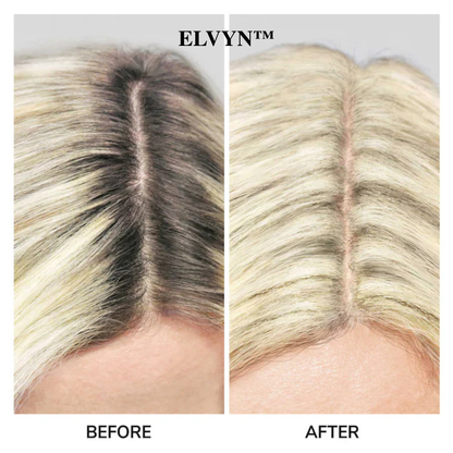 PureShade™ — Instantly Reclaim a Fuller, Naturally Youthful Hairline Without the Hassle