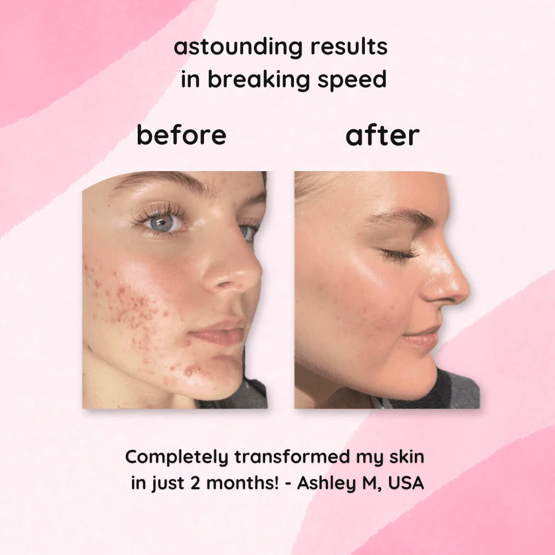 RadianceRush™ Renewal Pads — Wake Up Glowing with Smooth, Spot-Free Skin Every Day