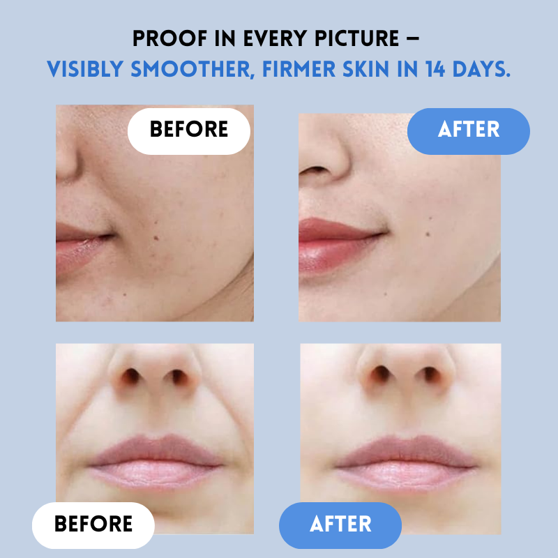 HydraLift™ — Instantly Smash Wrinkles and Glow with Youthful Radiance