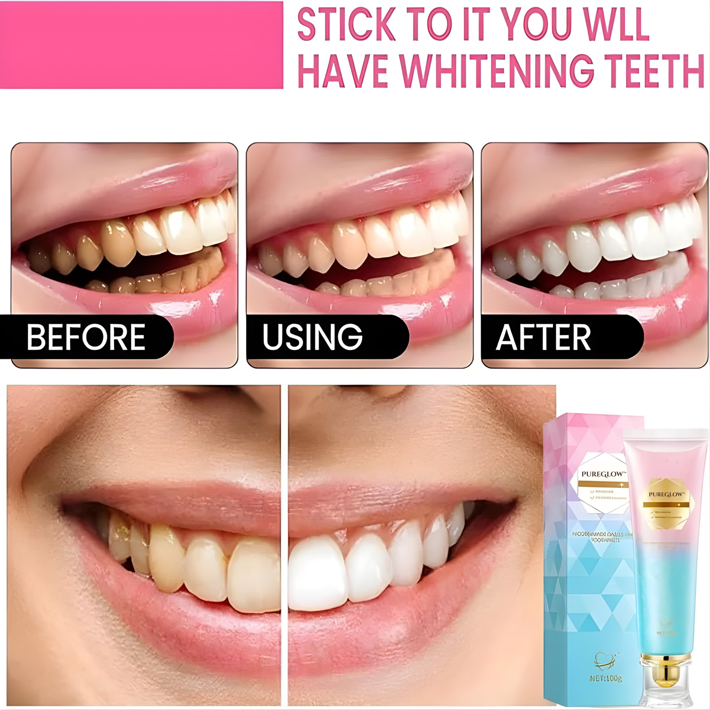 LumaBeam™ — Unlock a Stunning Smile That Radiates Confidence Every Day