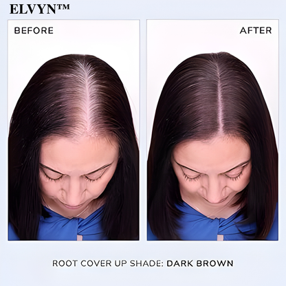 PureShade™ — Instantly Reclaim a Fuller, Naturally Youthful Hairline Without the Hassle