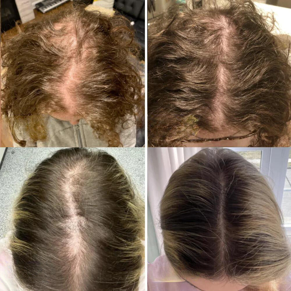 VitaThrive™ — Ignite Your Scalp’s Power for Thick, Lush Hair That Commands Attention