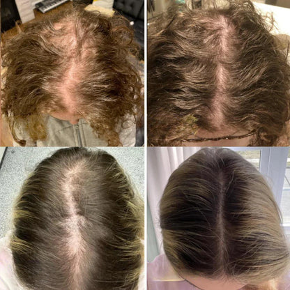 RadiantRoot™ — Ignite Your Scalp, Unlock Thick, Head-Turning Hair Every Day