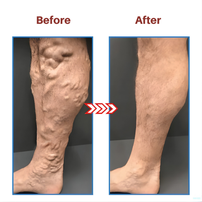 StrideEase™ — Feel Energized, Pain-Free Feet That Power You All Day Long