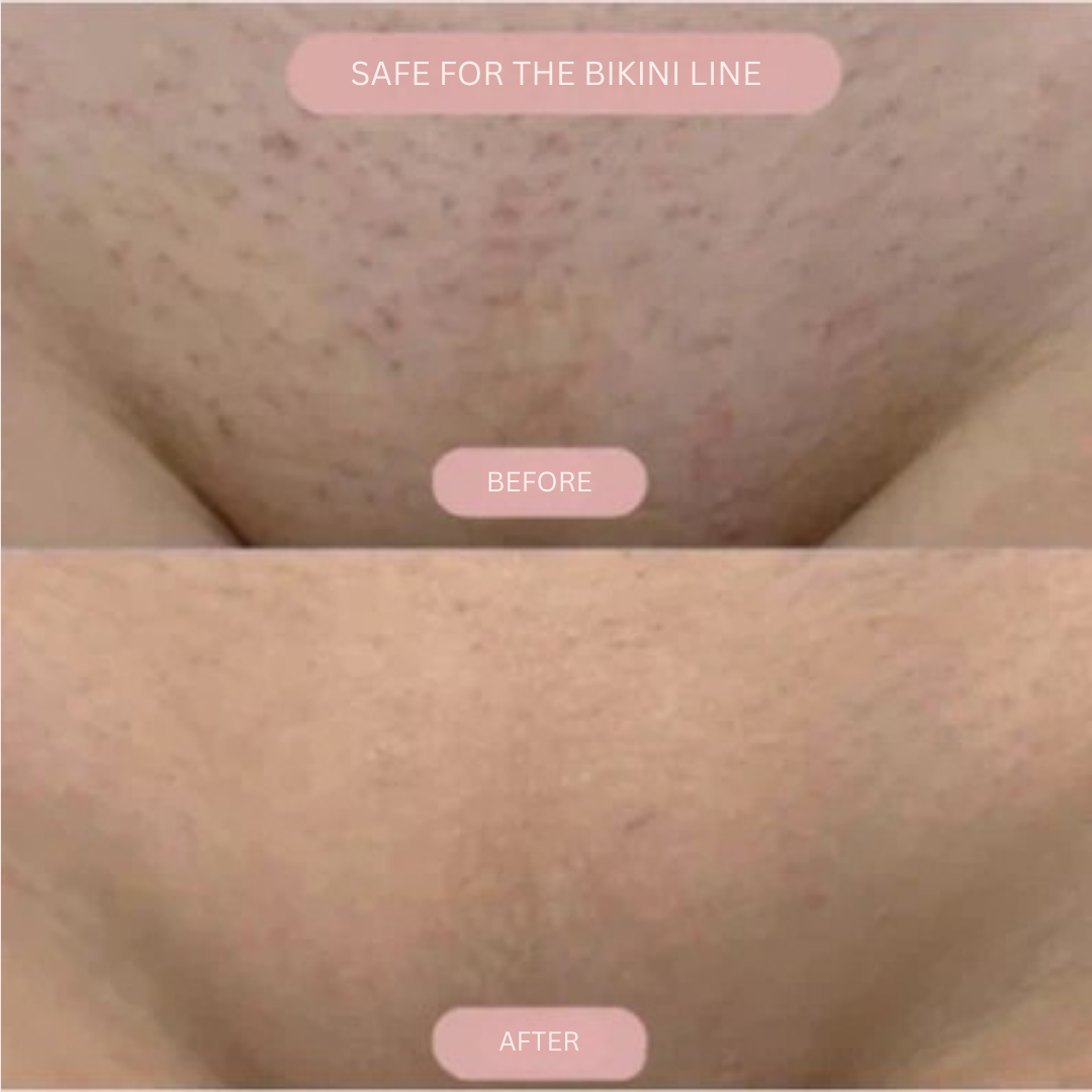 Velora™ — Experience Silky-Smooth, Irritation-Free Skin That Boosts Your Confidence Every Day