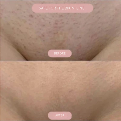 Velora™ — Experience Silky-Smooth, Irritation-Free Skin That Boosts Your Confidence Every Day