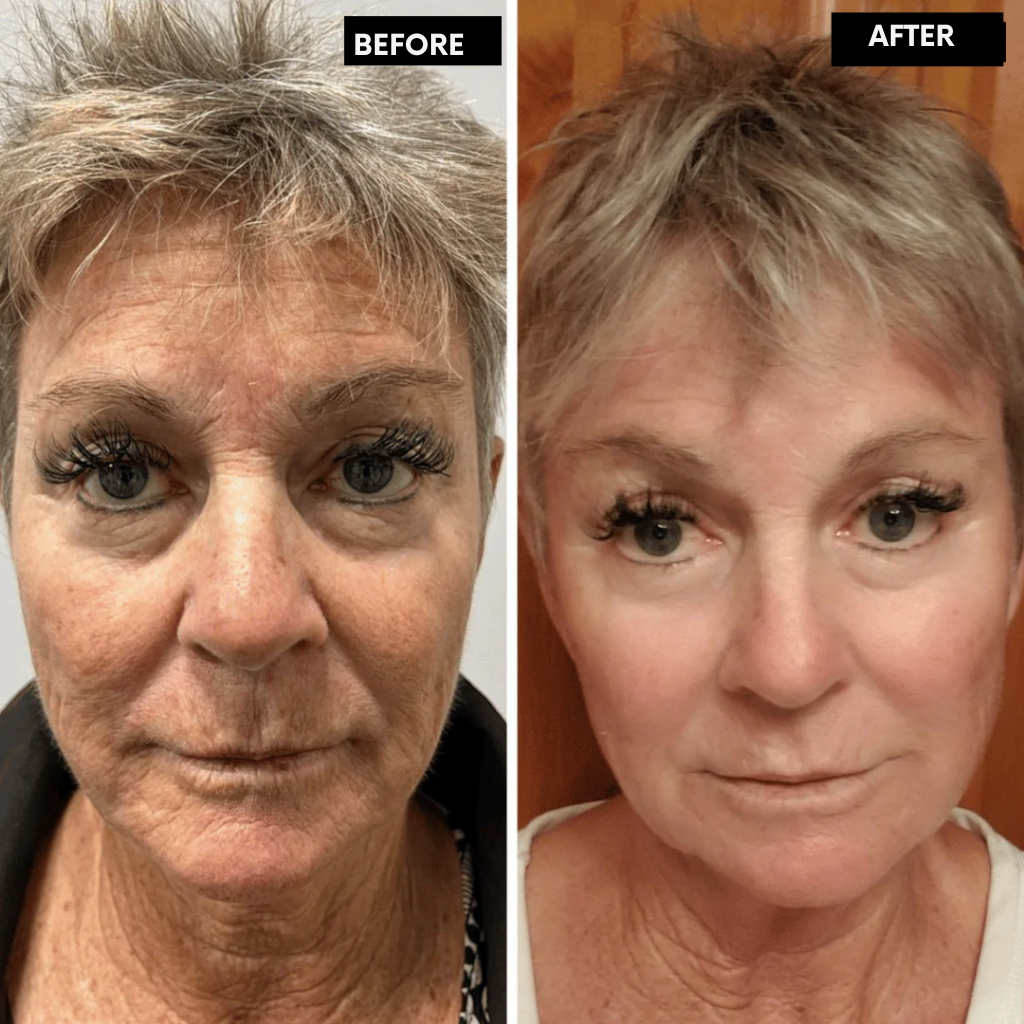 LumaLift™ — Unlock Radiant, Youthful Skin You’ll Crave to Show Off