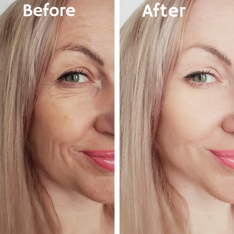 LumaLift™ — Instantly Tighten and Glow with Age-Defying Power