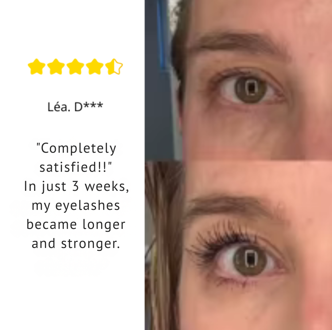 RadiVance™ Lash Serum — Wake Up to Fuller, Head-Turning Lashes That Boost Your Confidence Every Day