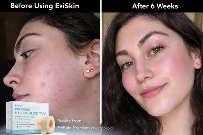 ClearLuxe™ — Heal Breakouts Fast and Reveal Your Radiant, Confident Glow