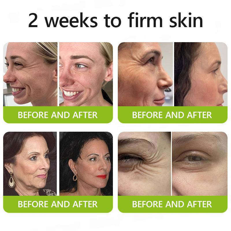 DermaVance™ — Unleash Youthful Lift and Radiance Without Needles or Pain
