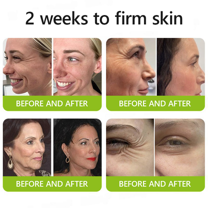 DermaVance™ — Unleash Youthful Lift and Radiance Without Needles or Pain